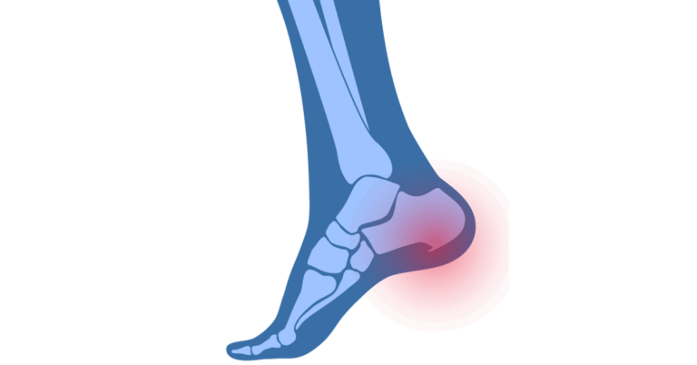 Ostroga-pietowa-1200x628-1