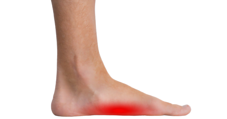 Płaskostopie-1200x628-1