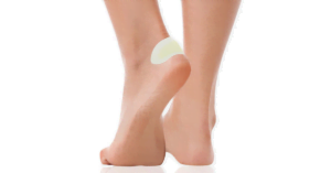 Pęcherz na stopie zabezpieczony plastrem na pęcherze