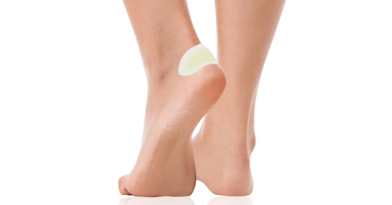 Pęcherz na stopie zabezpieczony plastrem na pęcherze