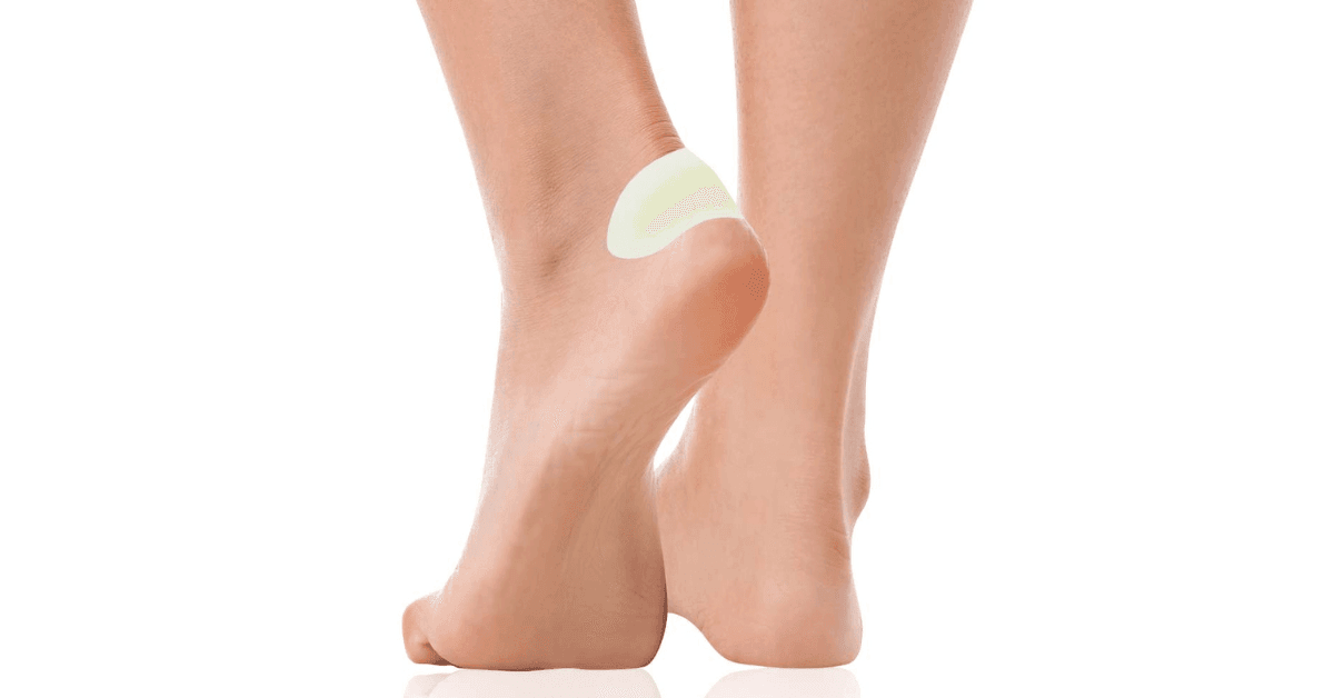 Pęcherz na stopie zabezpieczony plastrem na pęcherze